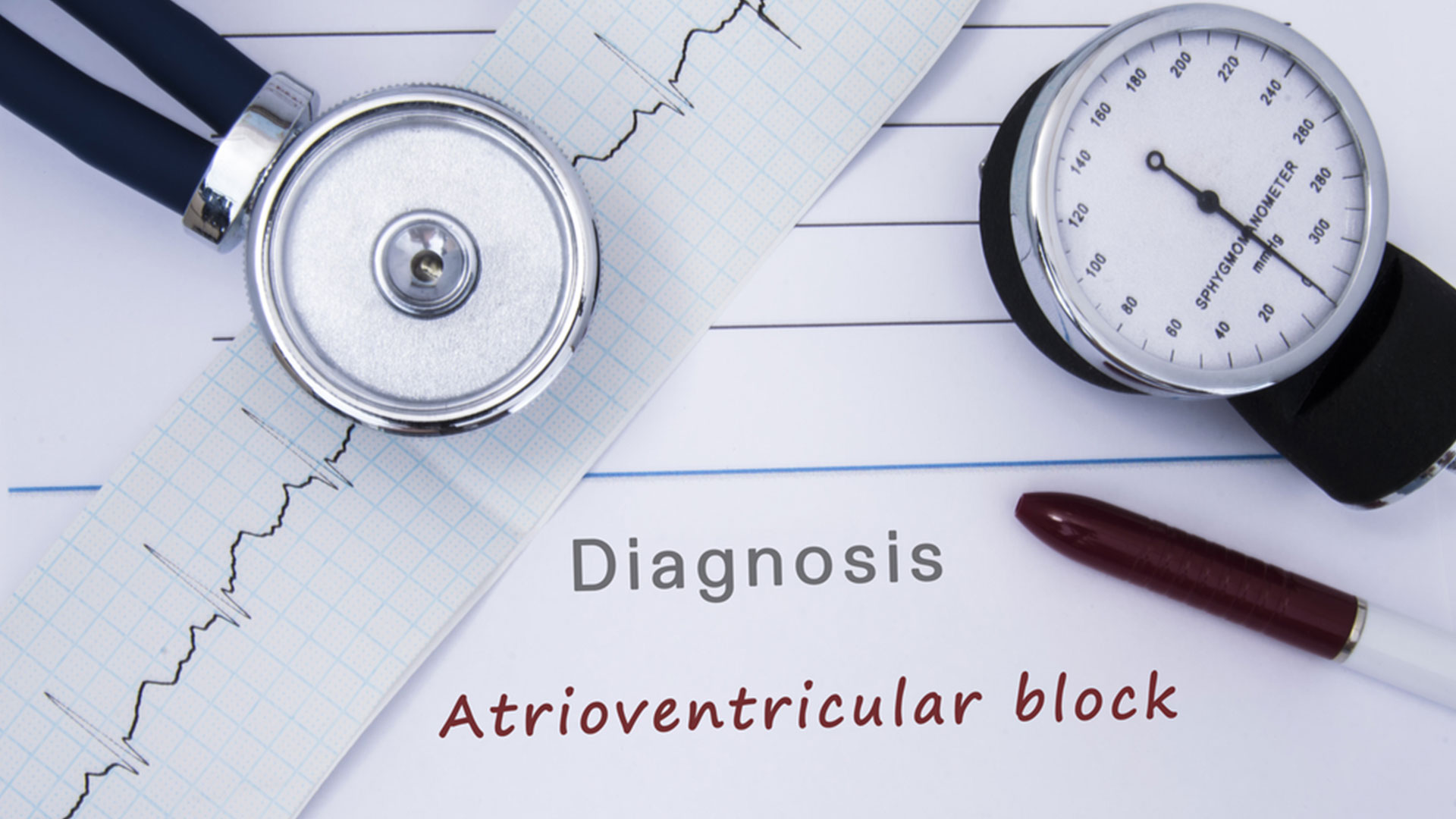 VA Disability Compensation for Atrioventricular Block...