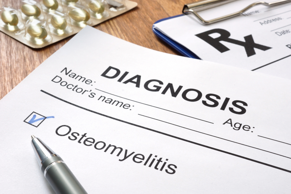 VA Ratings For Osteomyelitis...